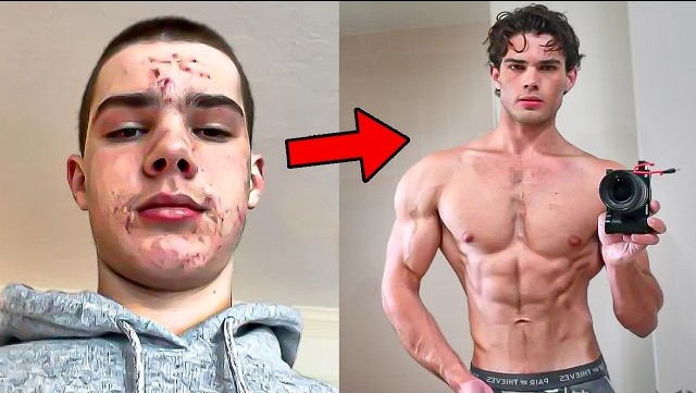 Before and after.